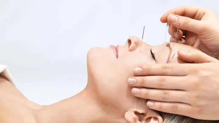 Man sieht eine Frau, die Akkupunkturnadel im Gesicht hat.